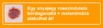 melanóma