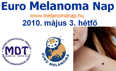 Melanoma napot tartottak Nyíregyházán